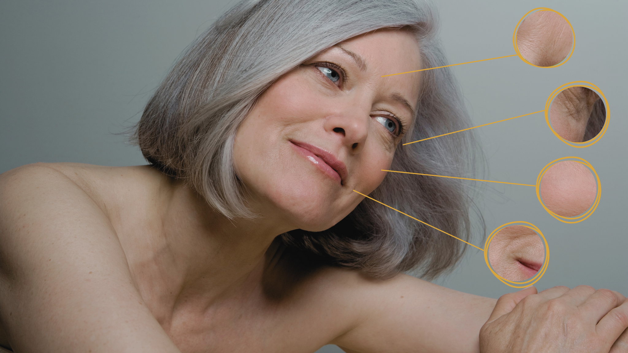 Comment traiter les 4 types de rides existants ?