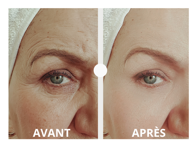 Résultats avant et après le sérum Cure de Jeunesse au bakuchiol Belle après 40 ans, réduction visible des rides et peau plus lisse