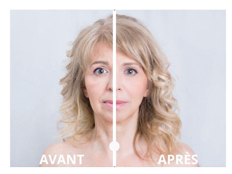 Résultats avant et après le sérum Cure de Relaxation aux peptides Belle après 40 ans, regard reposé et peau défatiguée