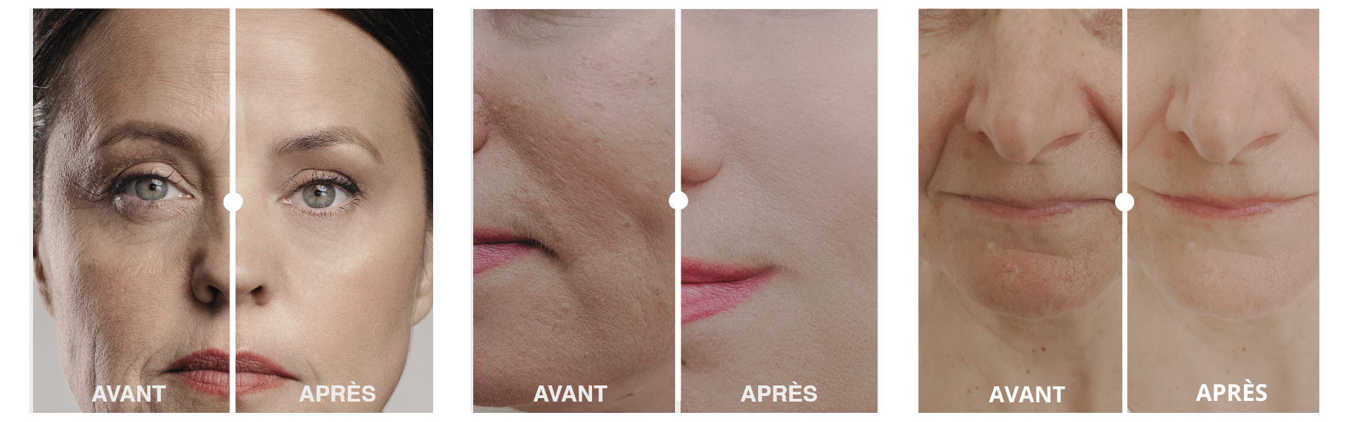 Routine hydratante peau mature – effet peau lisse et rebondie avant/après