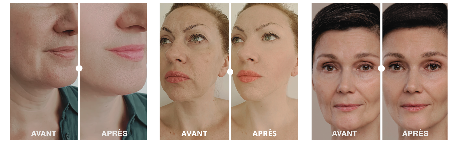 Avant / Après sur peau mature – résultats visibles après routine anti-âge naturelle certifiée