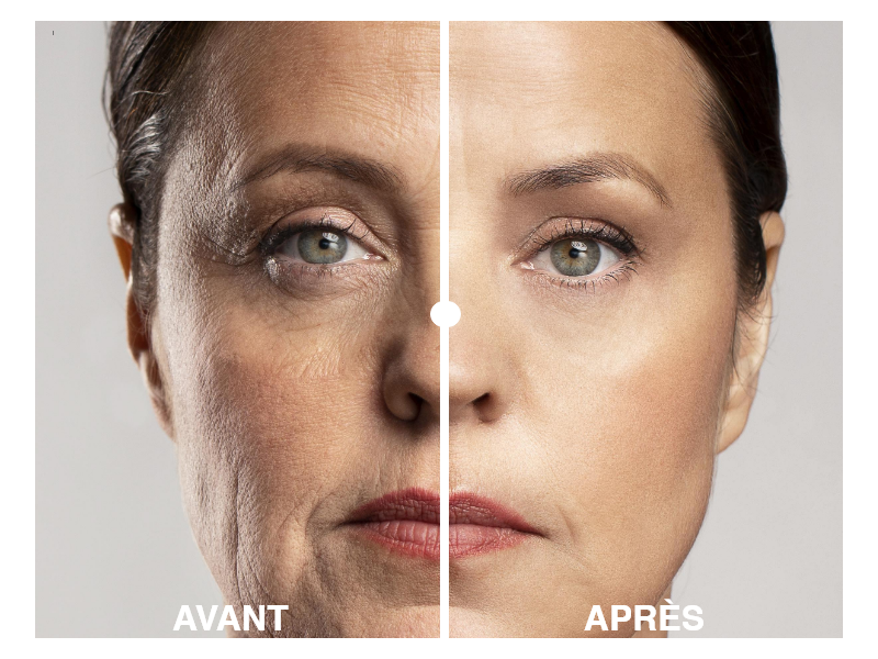 Résultats avant et après utilisation des soins Belle après 40 ans, peau lissée et éclatante